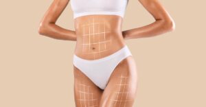 liposuction antalya
