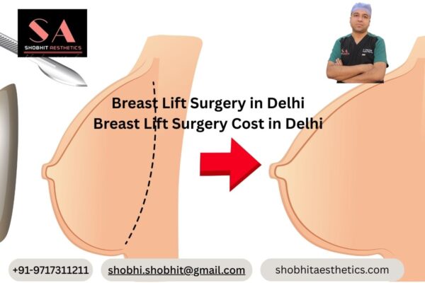 Breast Lift Surgery Cost in Delhi