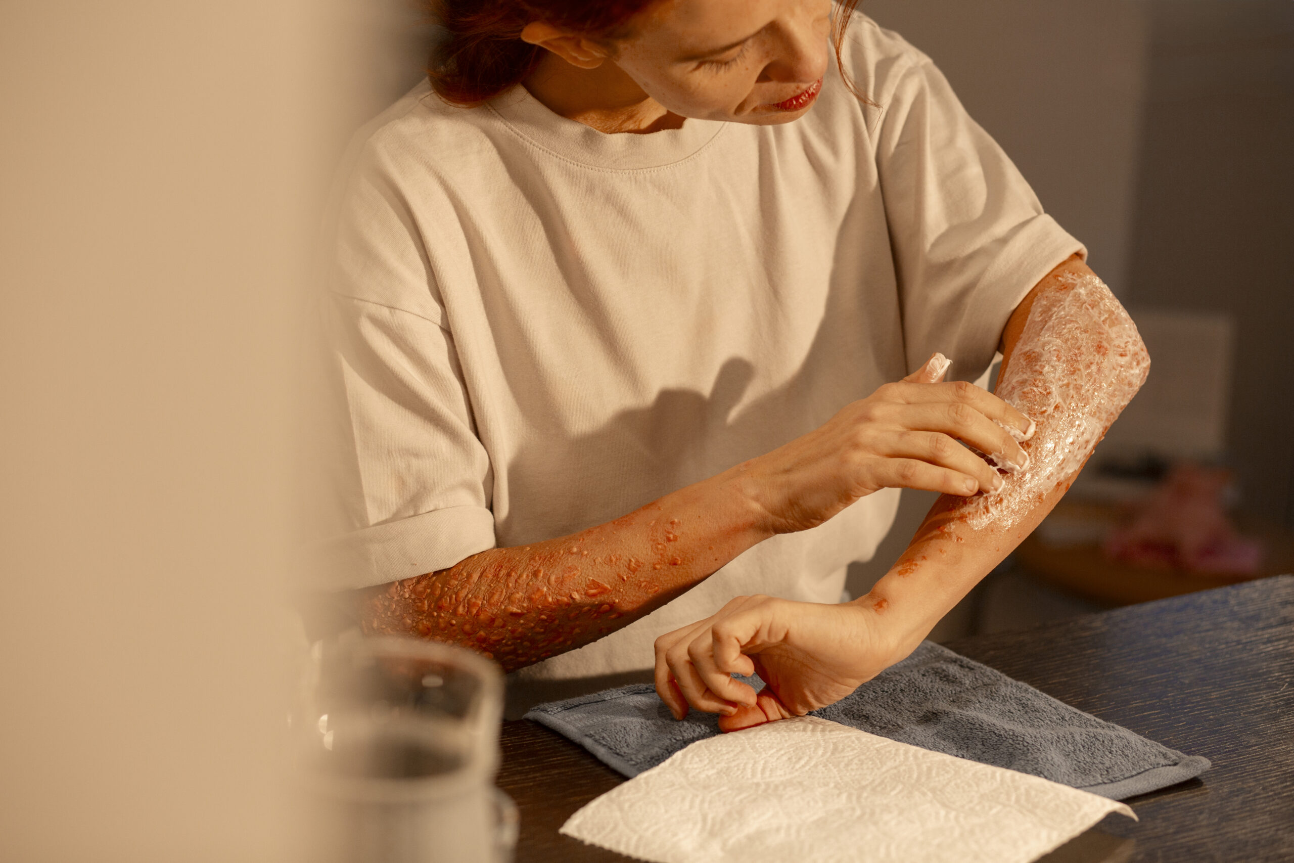 Ivermectin for Humans