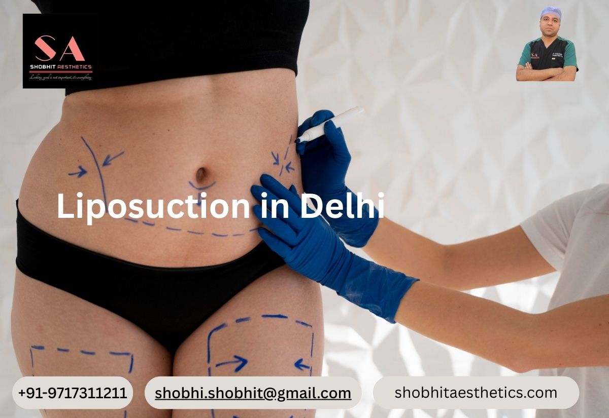 Liposuction Before After Results