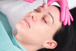 skin clinic Richmond