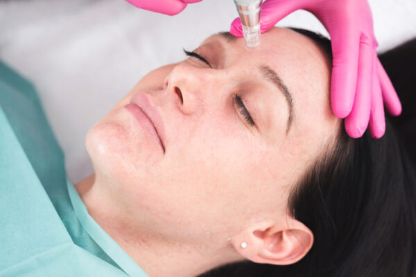 skin clinic Richmond