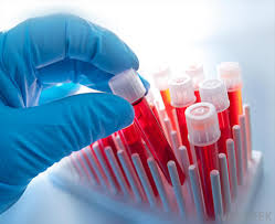 Forensic Biology and DNA Profiling