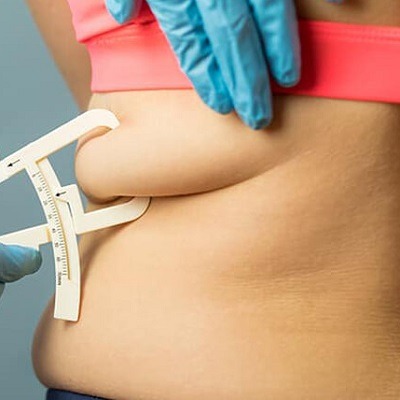 cost of liposuction in islamabad