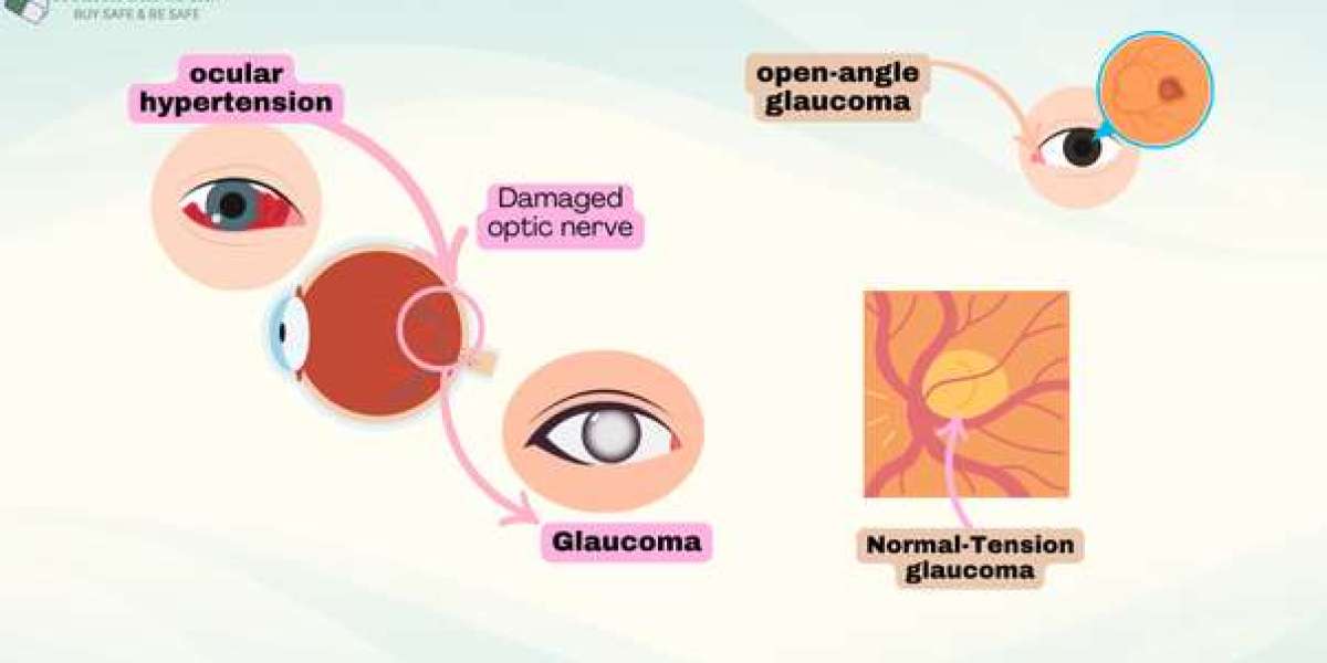 Lumigan 0.01 for eye care