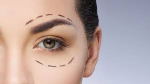 The Ultimate Guide to Upper Blepharoplasty in Jeddah
