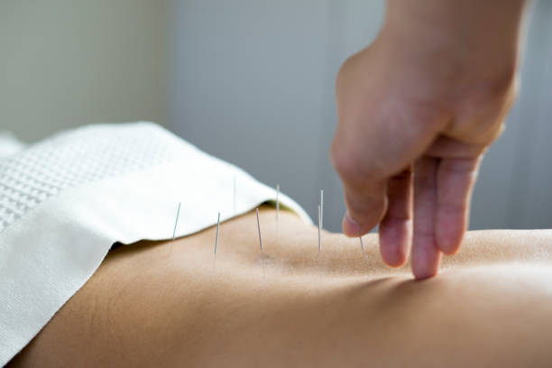 acupuncture clinic